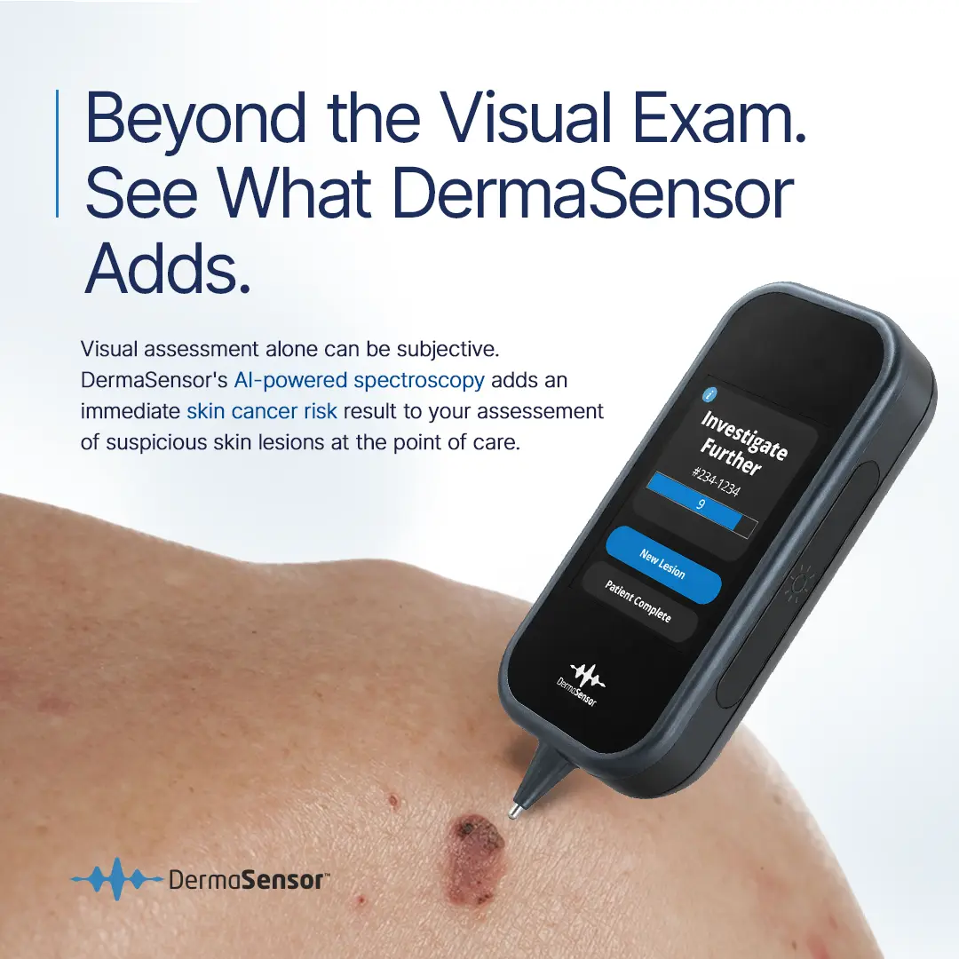 Can AI replace a dermatologist? DermaSensor AI powered spectroscopy device scanning a skin lesion and returning an Investigate Further result with a spectral score
