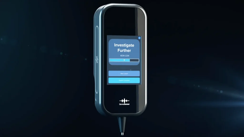 DermaSensor results screen on the handheld device showing an Investigate Further result with a spectral score of 7