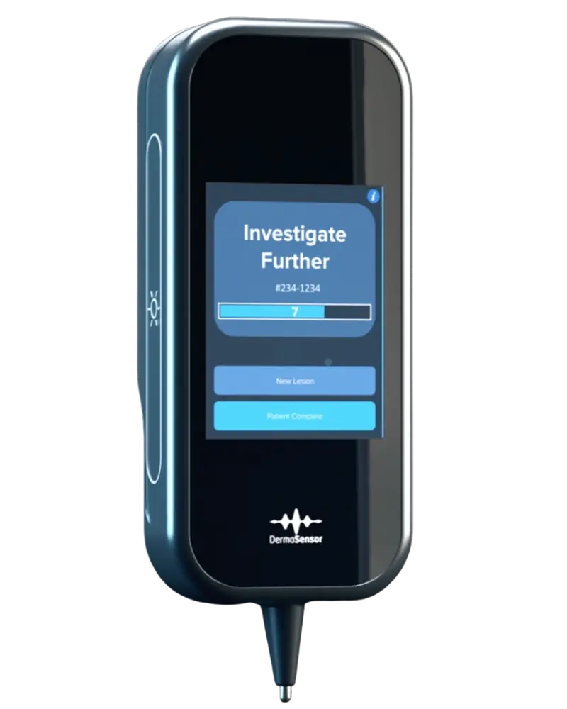Skin cancer detection device by DermaSensor used by physicians to evaluate suspicious skin lesions in clinical settings