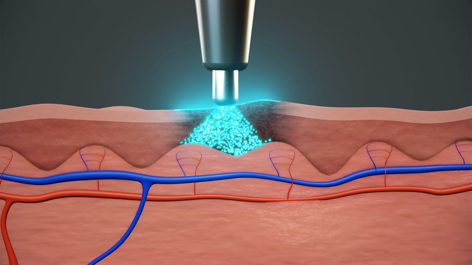 FDA Breakthrough Device using Optical Spectroscopy was Found to Significantly Increase